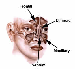 sinus2